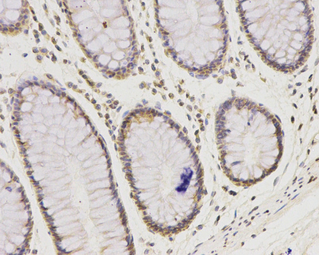 IFNAR1 Antibody in Immunohistochemistry (Paraffin) (IHC (P))