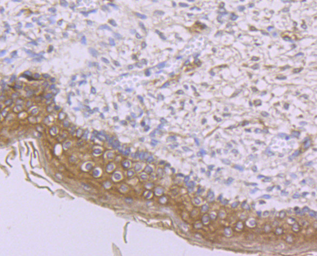 IFNAR1 Antibody in Immunohistochemistry (Paraffin) (IHC (P))