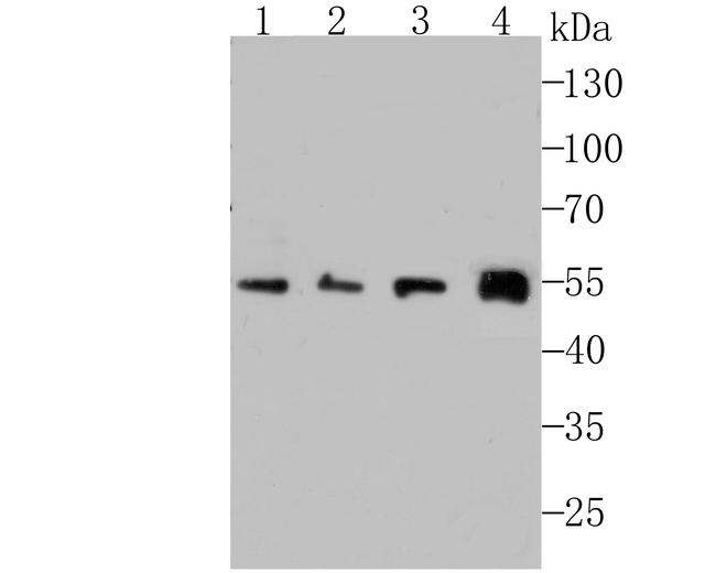 IFNAR1 Antibody in Western Blot (WB)