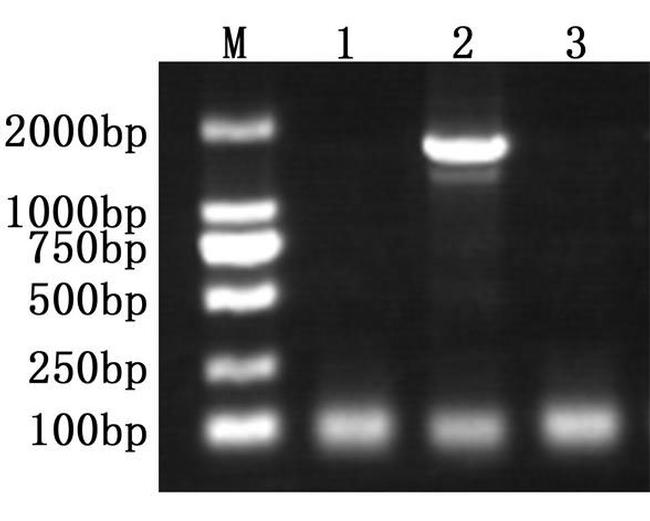 Taq DNA Polymerase Antibody in Functional Assay (FN)