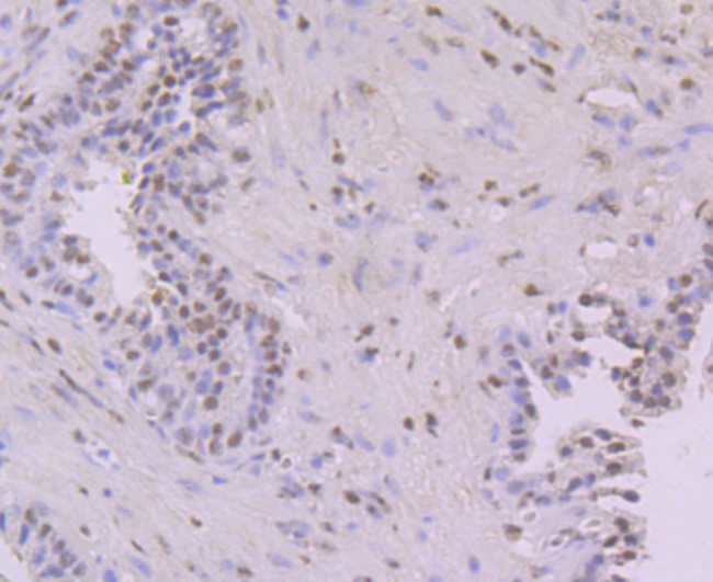 NFIB Antibody in Immunohistochemistry (Paraffin) (IHC (P))