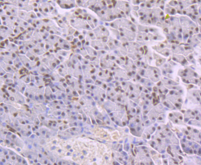 NFIB Antibody in Immunohistochemistry (Paraffin) (IHC (P))