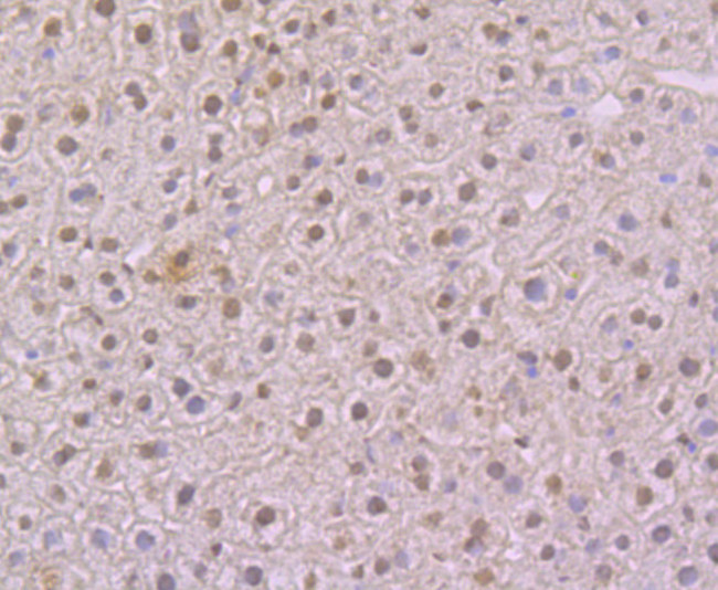 NFIB Antibody in Immunohistochemistry (Paraffin) (IHC (P))