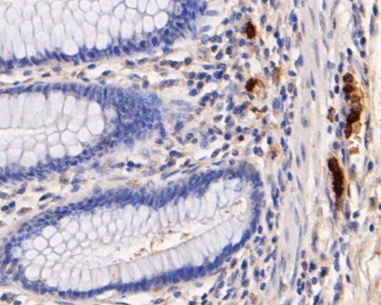 Myeloperoxidase Antibody in Immunohistochemistry (Paraffin) (IHC (P))