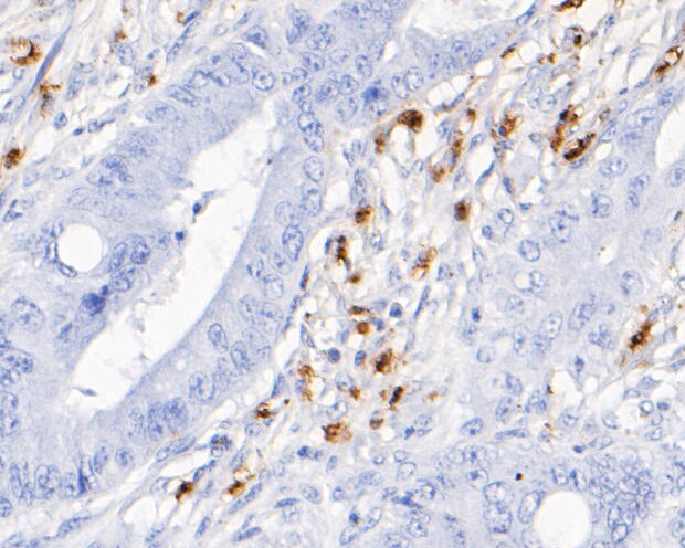 Myeloperoxidase Antibody in Immunohistochemistry (Paraffin) (IHC (P))