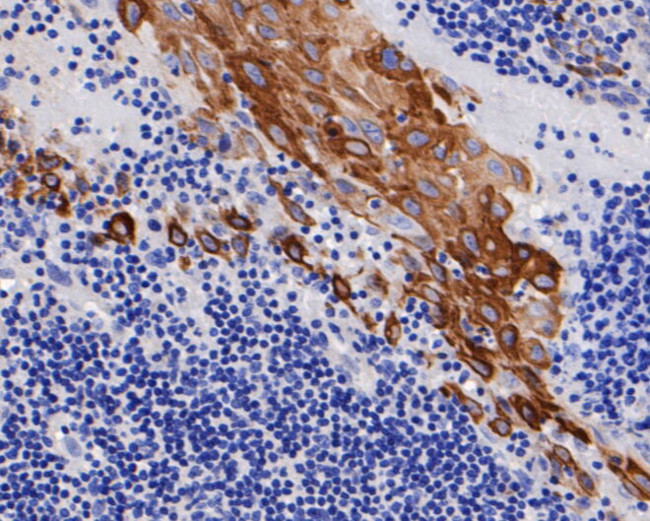 Cytokeratin 17 Antibody in Immunohistochemistry (Paraffin) (IHC (P))