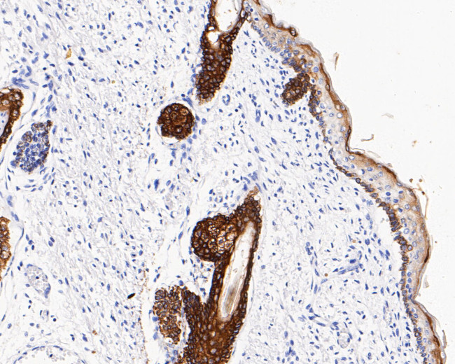 Cytokeratin 17 Antibody in Immunohistochemistry (Paraffin) (IHC (P))