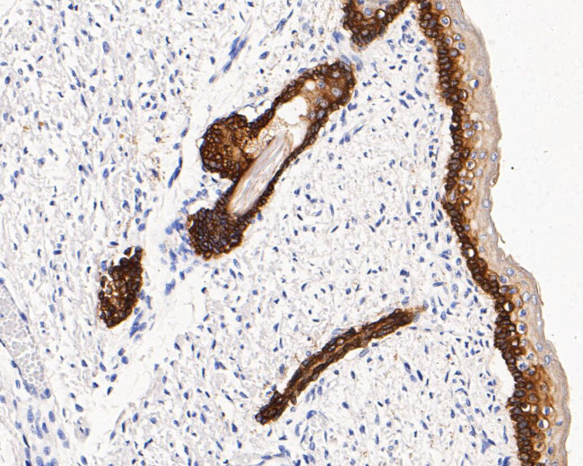 Cytokeratin 14 Antibody in Immunohistochemistry (Paraffin) (IHC (P))