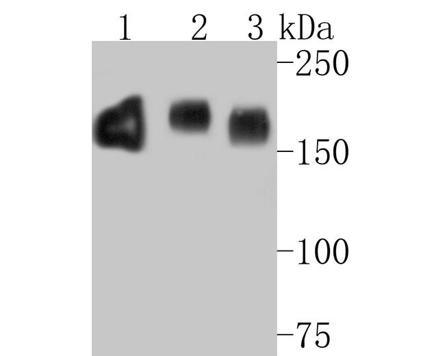 EGFR Antibody in Western Blot (WB)