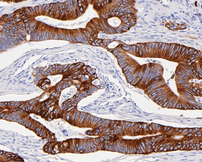 Cytokeratin 20 Antibody in Immunohistochemistry (Paraffin) (IHC (P))