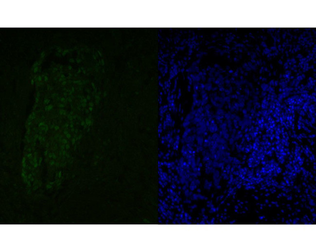 MSH6 Antibody in Immunohistochemistry (Paraffin) (IHC (P))