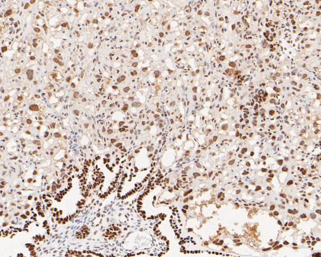 MSH6 Antibody in Immunohistochemistry (Paraffin) (IHC (P))