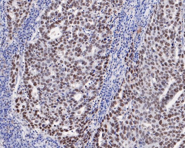 MSH6 Antibody in Immunohistochemistry (Paraffin) (IHC (P))