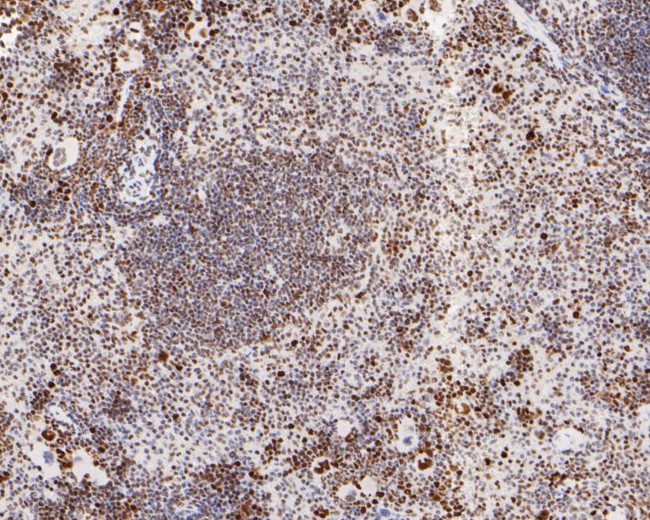 MSH6 Antibody in Immunohistochemistry (Paraffin) (IHC (P))