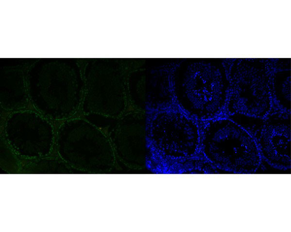 MSH6 Antibody in Immunohistochemistry (Paraffin) (IHC (P))