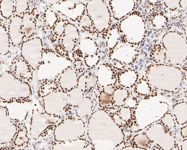 MSH6 Antibody in Immunohistochemistry (Paraffin) (IHC (P))