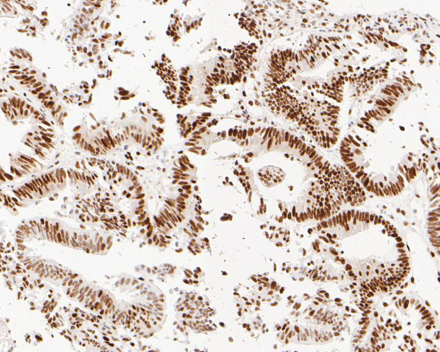 MSH6 Antibody in Immunohistochemistry (Paraffin) (IHC (P))