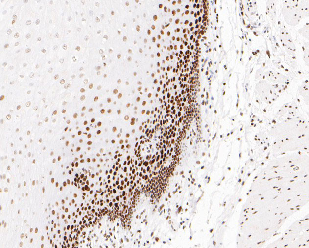 MSH6 Antibody in Immunohistochemistry (Paraffin) (IHC (P))