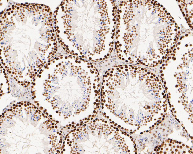 MSH6 Antibody in Immunohistochemistry (Paraffin) (IHC (P))