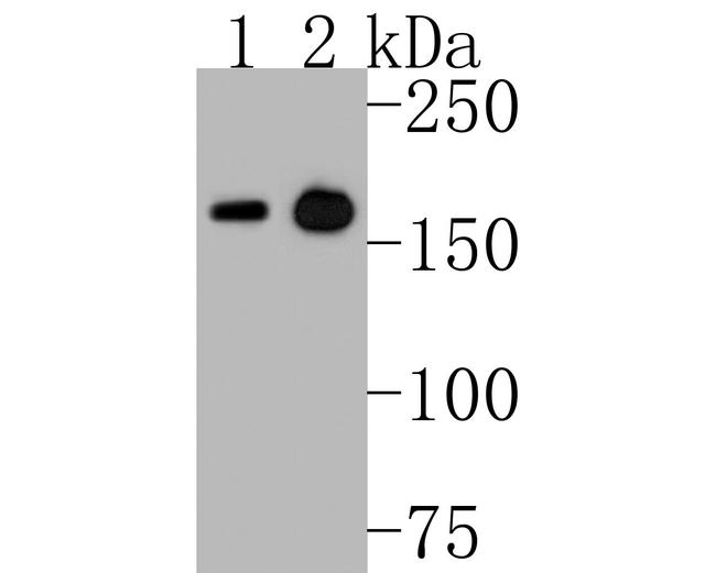 MSH6 Antibody in Western Blot (WB)