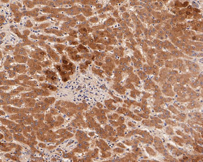 Glutamine Synthetase Antibody in Immunohistochemistry (Paraffin) (IHC (P))