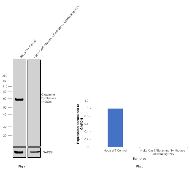 Glutamine Synthetase Antibody