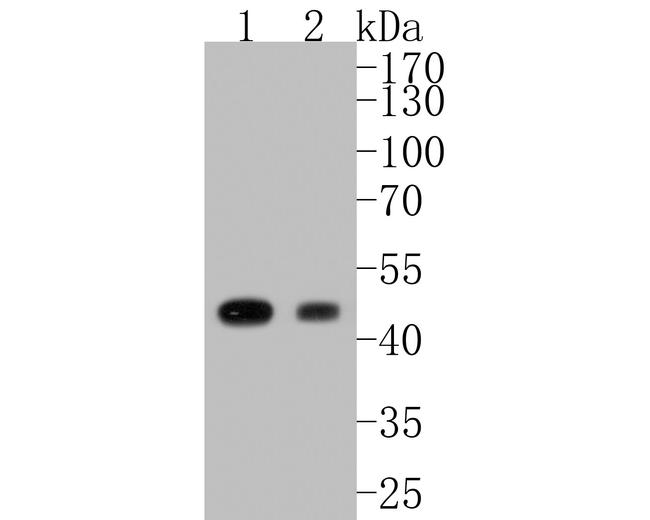 Glutamine Synthetase Antibody in Western Blot (WB)