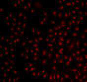 BMI-1 Antibody in Immunocytochemistry (ICC/IF)