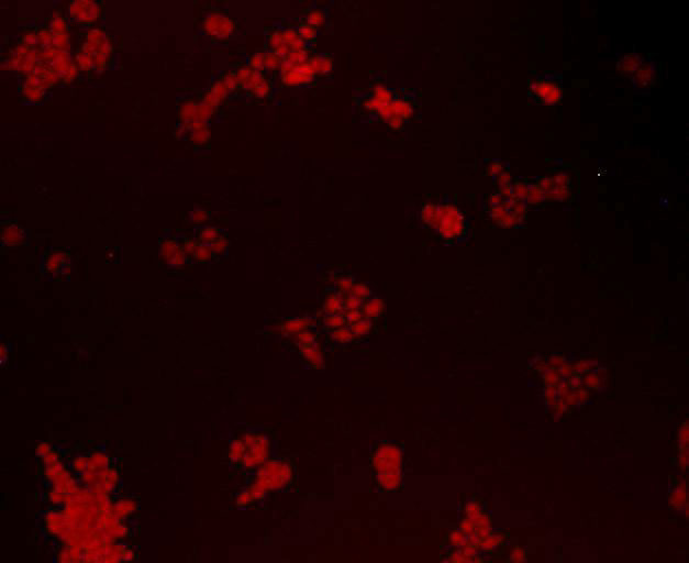 BMI-1 Antibody in Immunocytochemistry (ICC/IF)