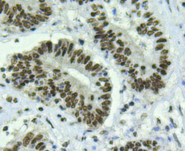 BMI-1 Antibody in Immunohistochemistry (Paraffin) (IHC (P))