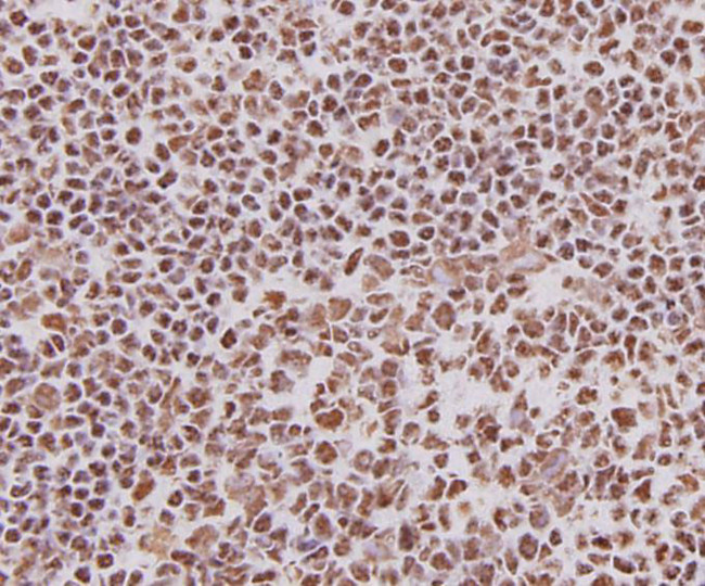 Ku70 Antibody in Immunohistochemistry (Paraffin) (IHC (P))