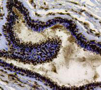 Ku70 Antibody in Immunohistochemistry (Paraffin) (IHC (P))