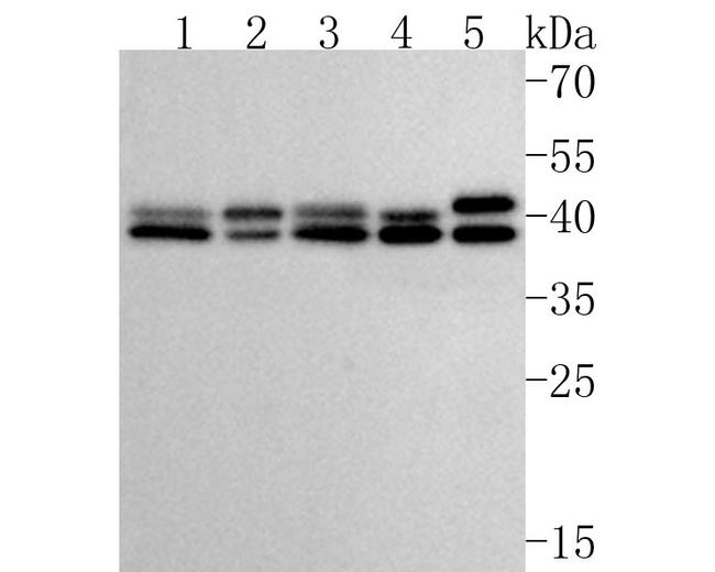 ERK1/ERK2 Antibody in Western Blot (WB)