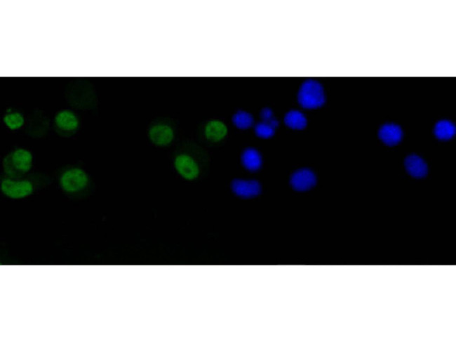 Cyclin D1 Antibody in Immunocytochemistry (ICC/IF)