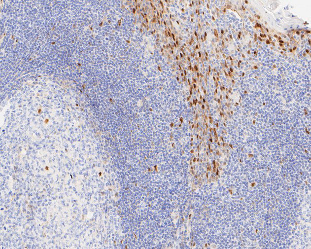 Cyclin D1 Antibody in Immunohistochemistry (Paraffin) (IHC (P))