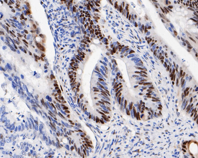 Cyclin D1 Antibody in Immunohistochemistry (Paraffin) (IHC (P))