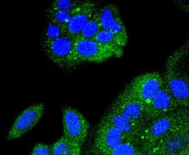 IkB alpha Antibody in Immunocytochemistry (ICC/IF)