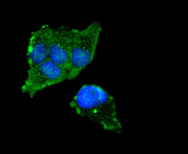 FOXO3A Antibody in Immunocytochemistry (ICC/IF)