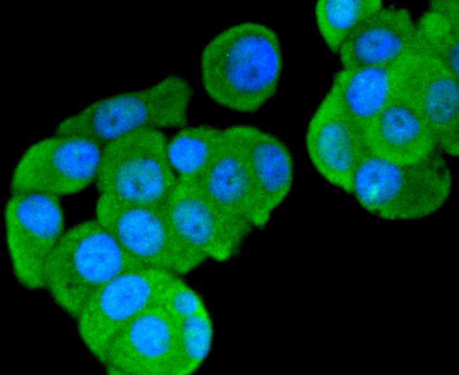 FOXO3A Antibody in Immunocytochemistry (ICC/IF)