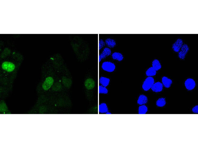 Survivin Antibody in Immunocytochemistry (ICC/IF)