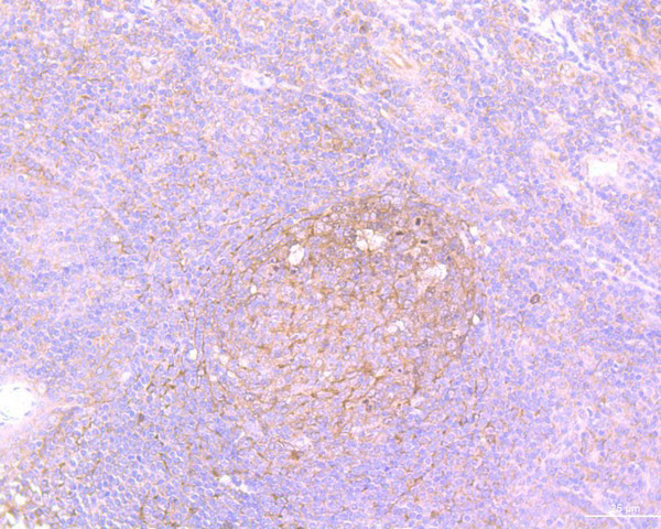 Survivin Antibody in Immunohistochemistry (Paraffin) (IHC (P))