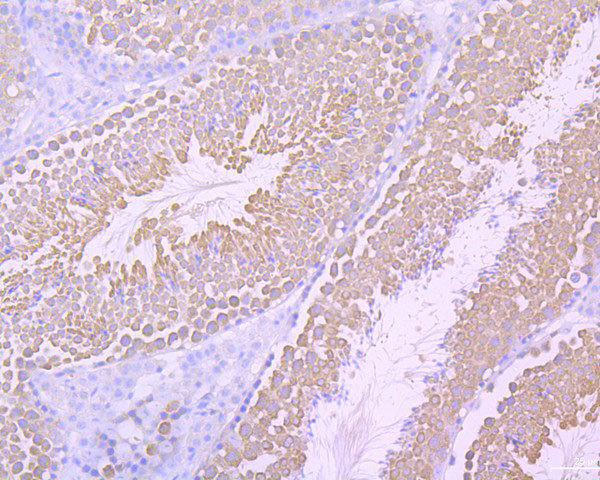 Survivin Antibody in Immunohistochemistry (Paraffin) (IHC (P))