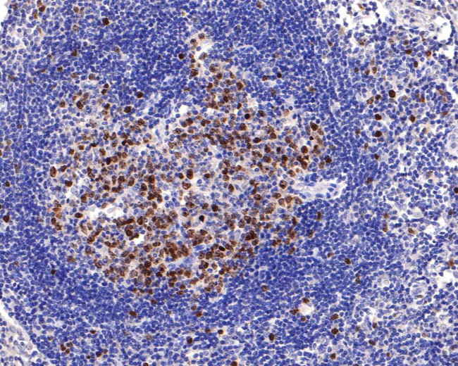 Survivin Antibody in Immunohistochemistry (Paraffin) (IHC (P))