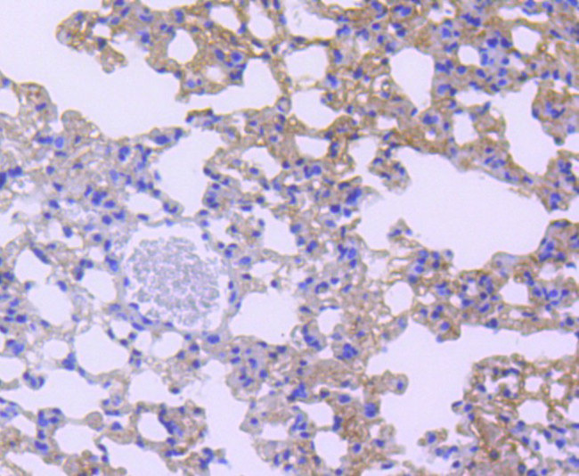 STAT6 Antibody in Immunohistochemistry (Paraffin) (IHC (P))