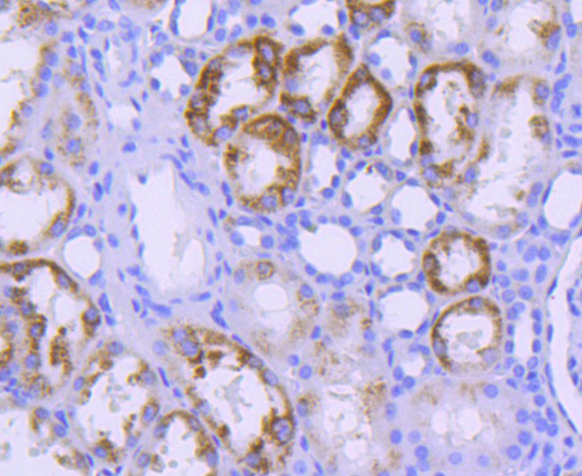 STAT6 Antibody in Immunohistochemistry (Paraffin) (IHC (P))