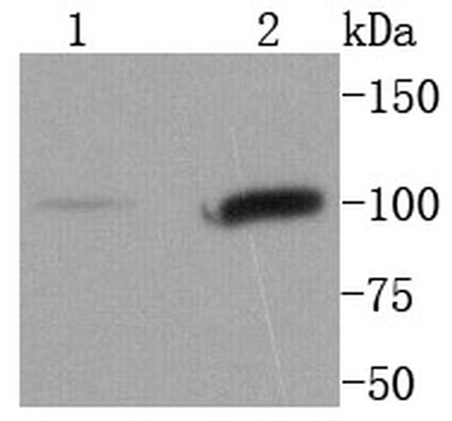 STAT6 Antibody in Western Blot (WB)