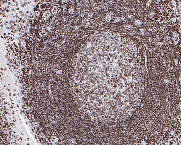 Phospho-JAK2 (Tyr1007, Tyr1008) Antibody in Immunohistochemistry (Paraffin) (IHC (P))