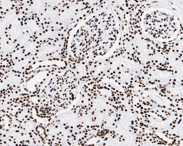 Phospho-JAK2 (Tyr1007, Tyr1008) Antibody in Immunohistochemistry (Paraffin) (IHC (P))