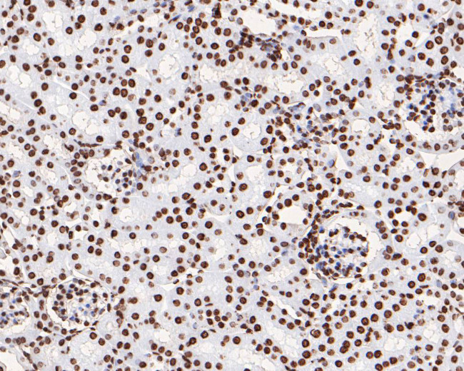 Phospho-JAK2 (Tyr1007, Tyr1008) Antibody in Immunohistochemistry (Paraffin) (IHC (P))