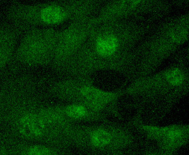 JAK2 Antibody in Immunocytochemistry (ICC/IF)